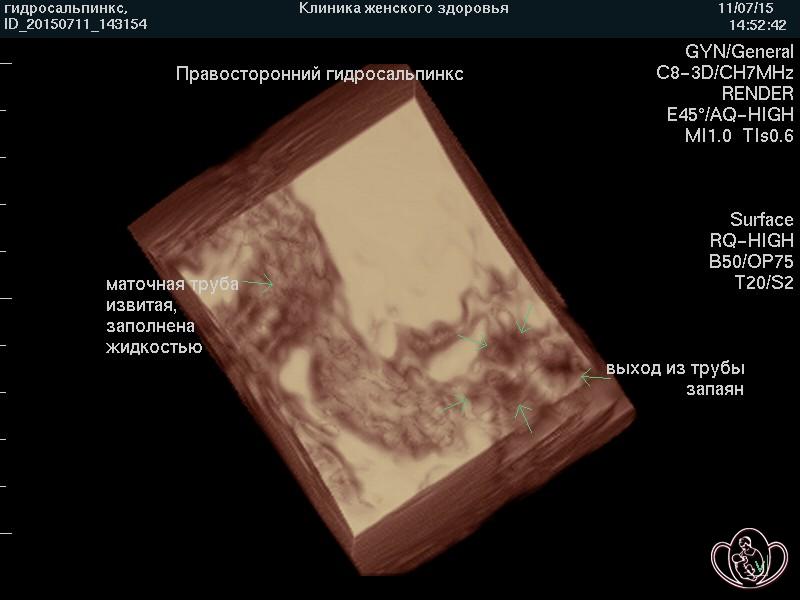 Боль внизу живота к вечеру