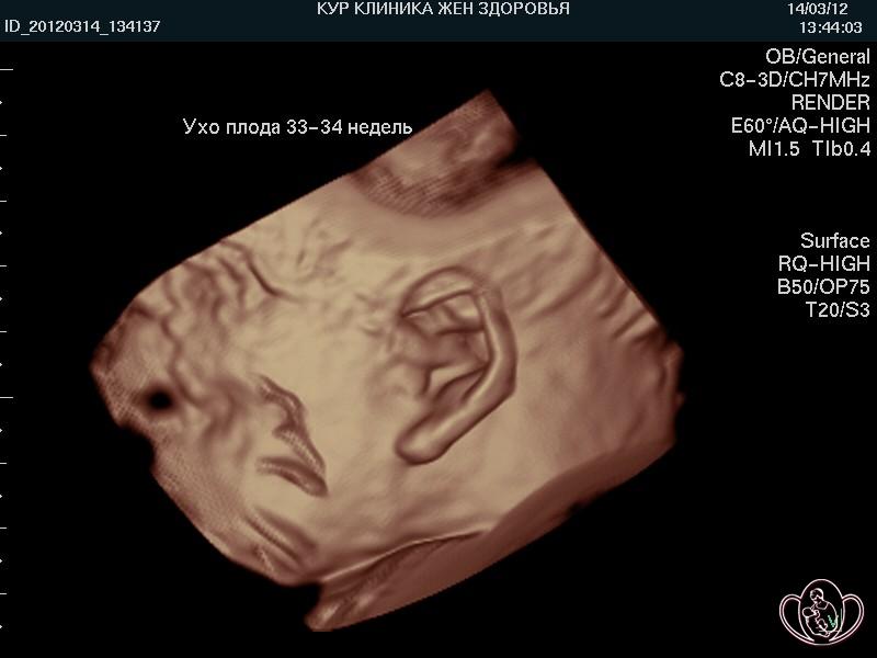 3D-фото уха плода 33-34 недель
