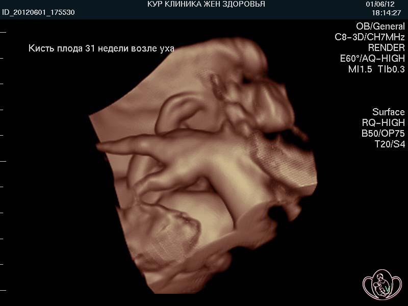  3D-фото: кисть плода 31 недели возле уха